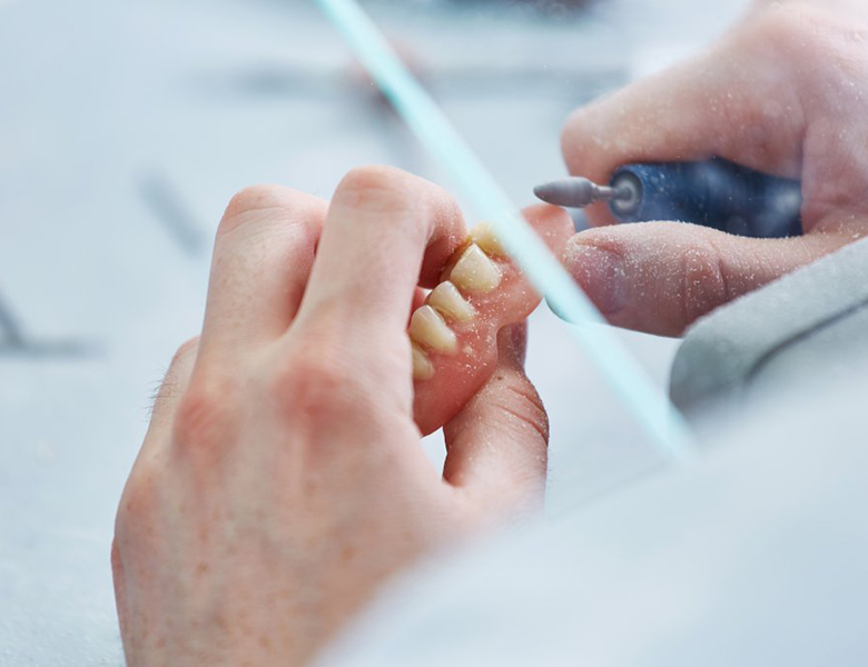 吉祥寺の歯医者、吉祥寺壱番館歯科医院の入れ歯（義歯）