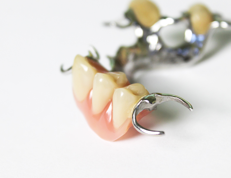 吉祥寺の歯医者、吉祥寺壱番館歯科医院の入れ歯（義歯）