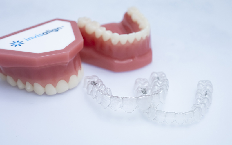 吉祥寺の歯医者、吉祥寺壱番館歯科医院で矯正歯科