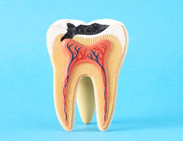 吉祥寺の歯医者、吉祥寺壱番館歯科医院の一般歯科