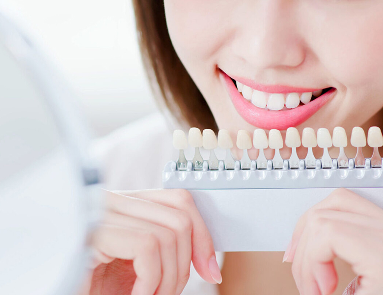 吉祥寺の歯医者、吉祥寺壱番館歯科医院のホワイトニング