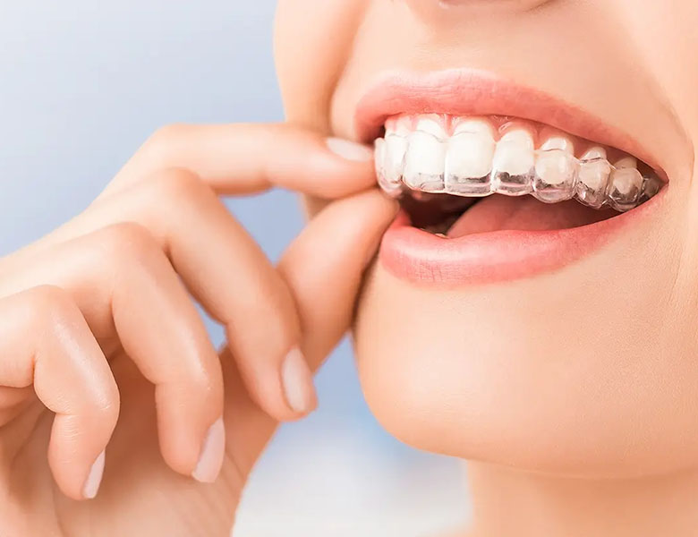 吉祥寺の歯医者、吉祥寺壱番館歯科医院の矯正歯科