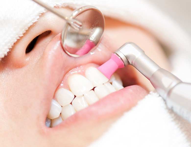 吉祥寺の歯医者、吉祥寺壱番館歯科医院の予防歯科