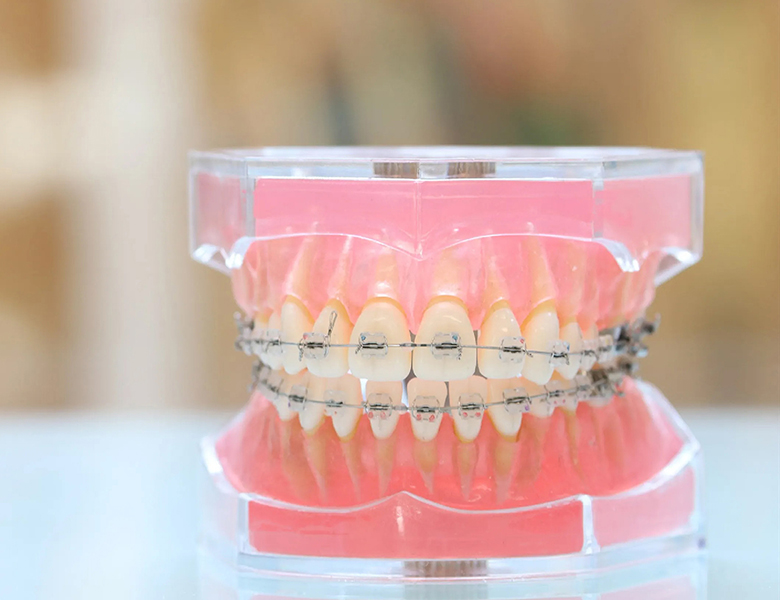 吉祥寺の歯医者、吉祥寺壱番館歯科医院の矯正歯科