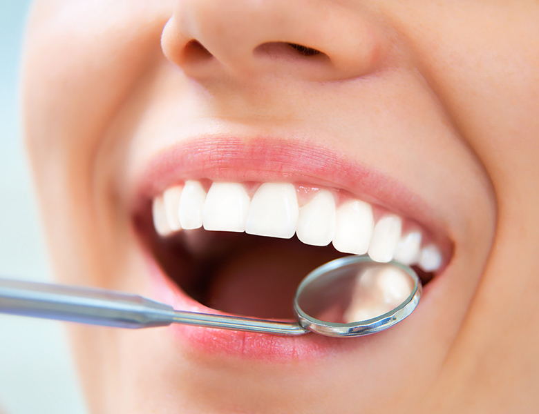 吉祥寺の歯医者、吉祥寺壱番館歯科医院の予防歯科