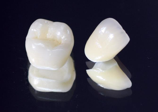 吉祥寺の歯医者、吉祥寺壱番館歯科医院の詰め物・被せ物